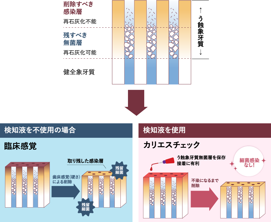 検知液を使用or不使用