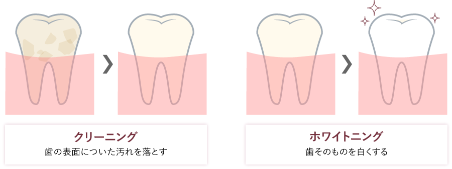 クリーニングとホワイトニング